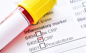Advanced Solution for C-Reactive Protein Detection through Fluorescence Immunochromatography