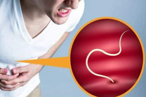 How a high fat diet allows expulsion of intestinal parasite worms