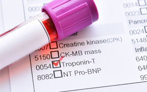 Cardiac Troponin T (cTnT) - Magnetic Particle Chemiluminescence Method (Acridinium Ester) / Fluorescence Immunochromatography Solution
