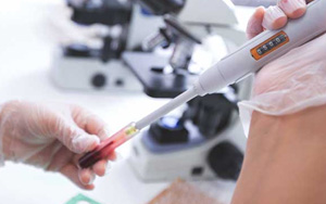 Myoglobin (Myo) - Magnetic Particle Chemiluminescence Method (Acridinium Ester) / Fluorescent Immunochromatography Solution