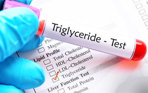 Raw and Auxiliary Materials for Triglyceride (TG) Detection Kit