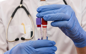 Creatine Kinase Isoenzyme (CK-MB) - Magnetic Particle Chemiluminescence Method (Acridinate)/Fluorescence Immunochromatography Solution