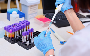 Soluble Growth Stimulating Expression Gene 2 Protein (ST2) - Magnetic Particle Chemiluminescence Method (Acridinium Ester)/Fluorescence Immunochromato