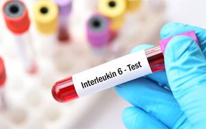 IL-6 Magnetic Particle Chemiluminescence/Fluorescence Immunochromatography Solution