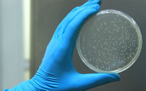 Recombinant TEV Protease (rTEV Protease)： Preferred Choice