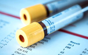 Raw Materials and Accessories for Glutathione Reductase (GR) Detection Kit